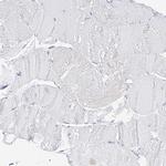 ZZEF1 Antibody in Immunohistochemistry (Paraffin) (IHC (P))