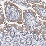 ZZEF1 Antibody in Immunohistochemistry (Paraffin) (IHC (P))