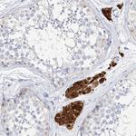 ZZEF1 Antibody in Immunohistochemistry (Paraffin) (IHC (P))