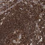 Adenylate Kinase 9 Polyclonal Antibody