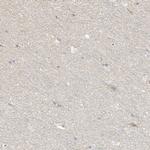 UPK1B Polyclonal Antibody