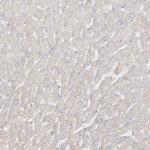 UPK1B Antibody in Immunohistochemistry (Paraffin) (IHC (P))