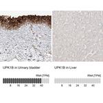 UPK1B Antibody in Immunohistochemistry (IHC)