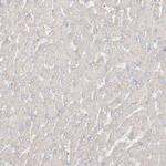 UPK1B Antibody in Immunohistochemistry (IHC)