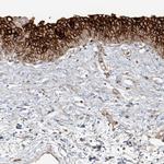 UPK1B Antibody in Immunohistochemistry (IHC)