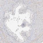 UPK1B Antibody in Immunohistochemistry (Paraffin) (IHC (P))