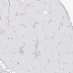 UPK1B Antibody in Immunohistochemistry (Paraffin) (IHC (P))