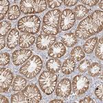 UPK1B Antibody in Immunohistochemistry (Paraffin) (IHC (P))