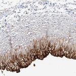 UPK1B Polyclonal Antibody