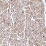 RPS25 Antibody in Immunohistochemistry (IHC)