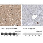 REEP2 Polyclonal Antibody