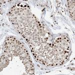 AURKAIP1 Antibody in Immunohistochemistry (Paraffin) (IHC (P))