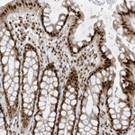 AURKAIP1 Antibody in Immunohistochemistry (Paraffin) (IHC (P))
