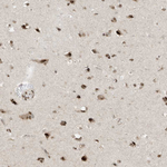 AURKAIP1 Antibody in Immunohistochemistry (Paraffin) (IHC (P))