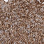 SNAP29 Polyclonal Antibody