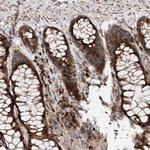SNAP29 Antibody in Immunohistochemistry (Paraffin) (IHC (P))