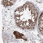C6orf57 Antibody in Immunohistochemistry (IHC)