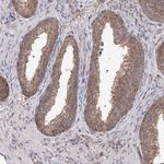 C6orf57 Antibody in Immunohistochemistry (IHC)