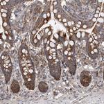 C6orf57 Antibody in Immunohistochemistry (IHC)