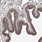 C6orf57 Antibody in Immunohistochemistry (IHC)