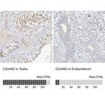 C2orf42 Antibody in Immunohistochemistry (IHC)