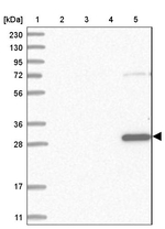 TXNDC9 Antibody in Western Blot (WB)