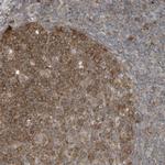 TXNDC9 Polyclonal Antibody