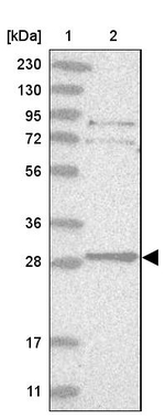 TXNDC9 Antibody in Western Blot (WB)