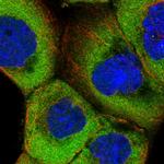 TXNDC9 Polyclonal Antibody