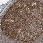 TXNDC9 Antibody in Immunohistochemistry (Paraffin) (IHC (P))