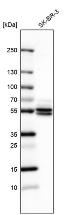 ATP6V1B1 Antibody in Western Blot (WB)