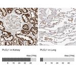 PLCL1 Polyclonal Antibody
