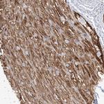 PLCL1 Antibody in Immunohistochemistry (IHC)