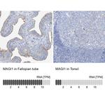 MAGI1 Polyclonal Antibody