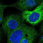 LCLAT1 Polyclonal Antibody