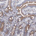LCLAT1 Antibody in Immunohistochemistry (Paraffin) (IHC (P))