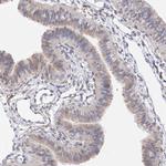LCLAT1 Antibody in Immunohistochemistry (Paraffin) (IHC (P))