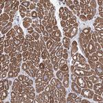 LCLAT1 Antibody in Immunohistochemistry (Paraffin) (IHC (P))