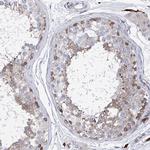 LCLAT1 Antibody in Immunohistochemistry (Paraffin) (IHC (P))