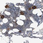 NALCN Polyclonal Antibody