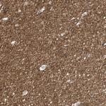 NALCN Polyclonal Antibody