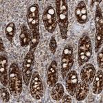 COA3 Antibody in Immunohistochemistry (Paraffin) (IHC (P))
