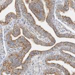 COA3 Antibody in Immunohistochemistry (Paraffin) (IHC (P))