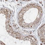COA3 Antibody in Immunohistochemistry (Paraffin) (IHC (P))