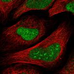 TSPYL1 Polyclonal Antibody