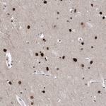 TSPYL1 Antibody in Immunohistochemistry (Paraffin) (IHC (P))
