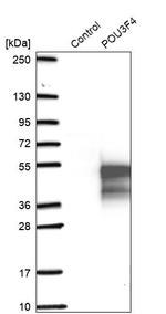 POU3F4 Polyclonal Antibody