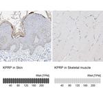 KPRP Polyclonal Antibody