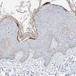 KPRP Antibody in Immunohistochemistry (IHC)