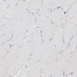 KPRP Antibody in Immunohistochemistry (IHC)